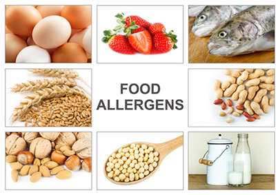 Food Allergens Food Allergens